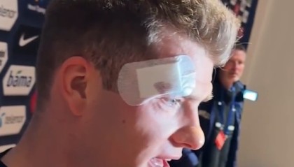 开云登录线上-瑟尔洛特头部被撞后表示无碍：我没事，幸运的是没有脑震荡